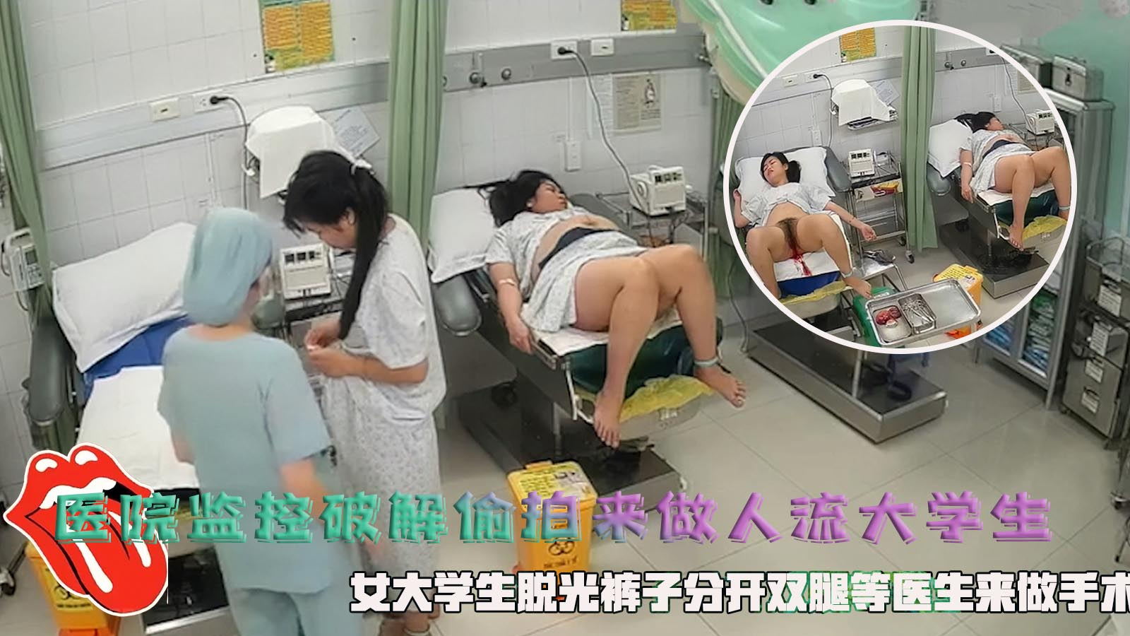 医院监控破解偷拍来做人流大学生，女大学生脱光裤子分开双腿等医生来做手术。